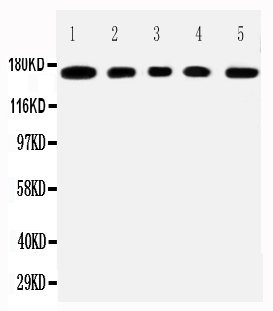 WB - Anti-MUC1 Antibody ABO11610